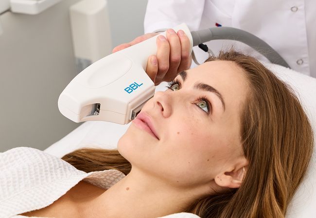 Векторный лифтинг для подтяжки лица